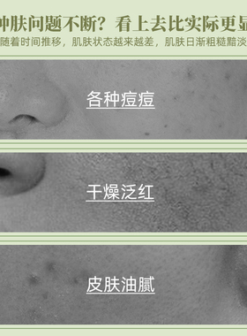 祛痘抑油光淡印深修护