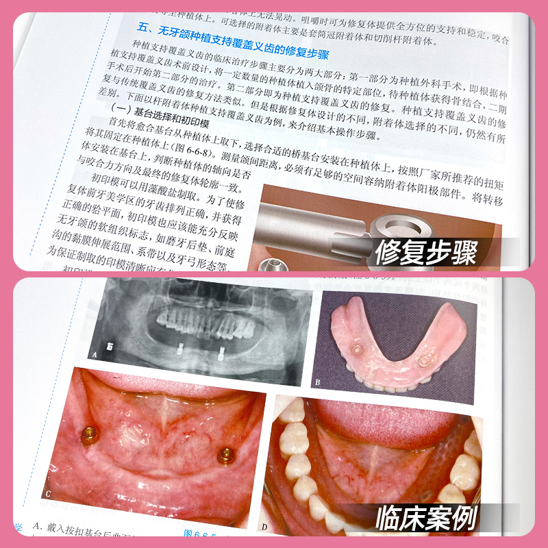 人卫版口腔解剖生理学第7版第七版第八轮十三五规划教材大学专科本科硕士口腔专业课程口腔医学教材种植解剖生理正畸牙体牙髓病学-图3