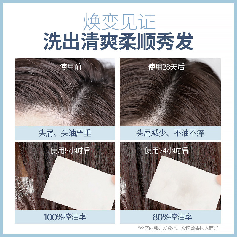 丝芬蓝色除螨去屑止痒控油露洗头膏 丝芬洗发水