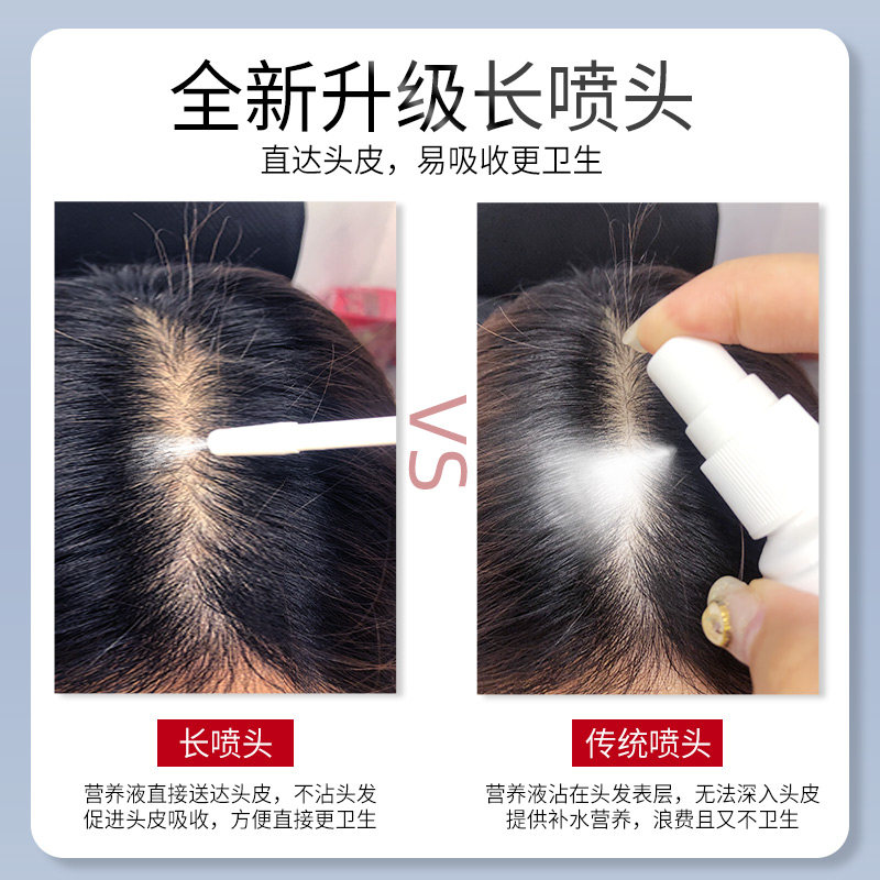 采乐干性头皮头发补水精华护理液 绿邮家居发膜/护发产品