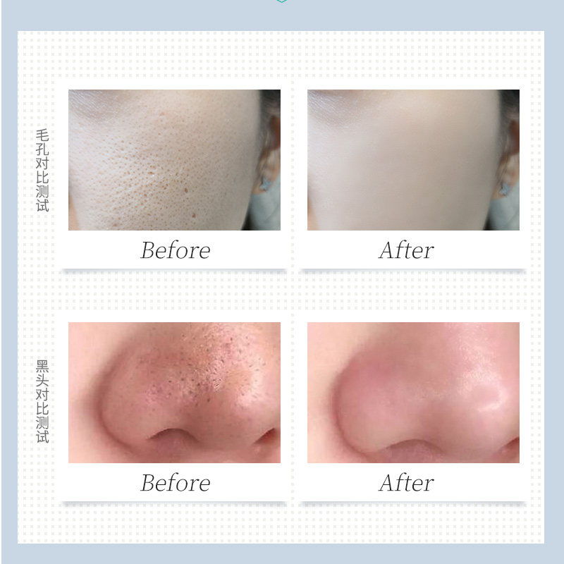 清洁收缩毛孔去黑头粉刺排毒泥膜 瑞倪维儿魅乐购涂抹面膜