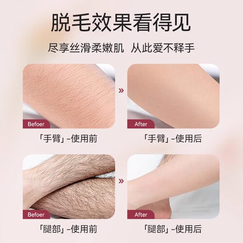 mayllie/玛贝拉脱毛蜡纸脱毛膏蜜蜡纸撕拉式不永久男女士专用腿部 - 图1
