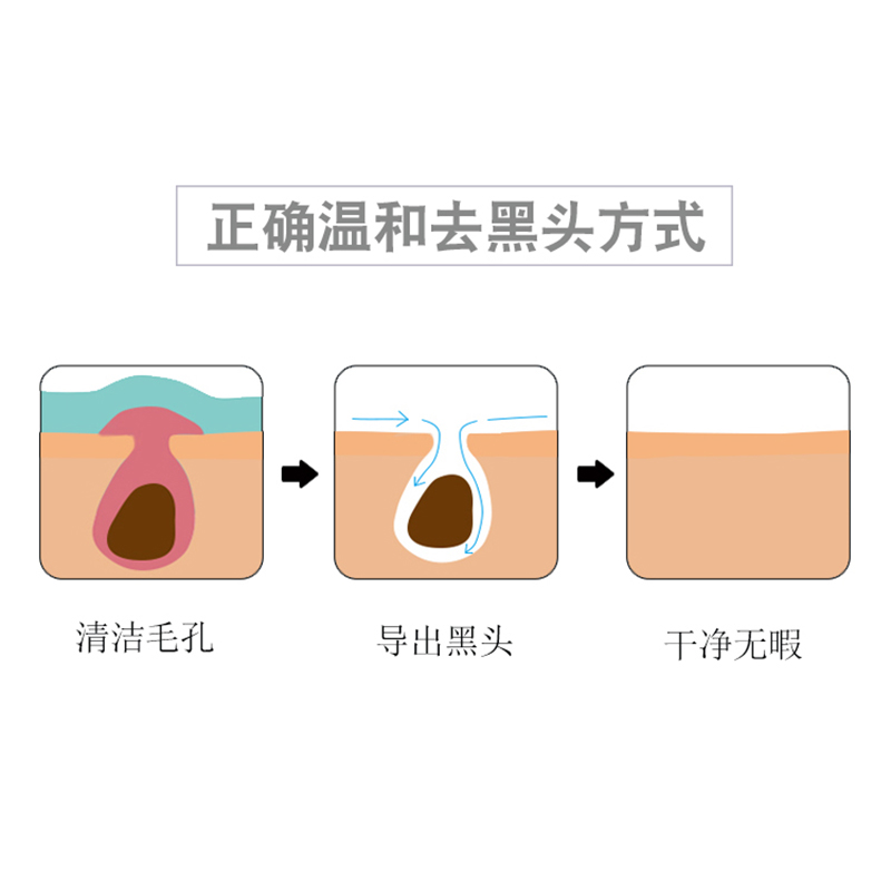 黑头导出液祛闭口粉刺水去黑头收缩毛孔全脸美容院专用韩国小气泡-图1