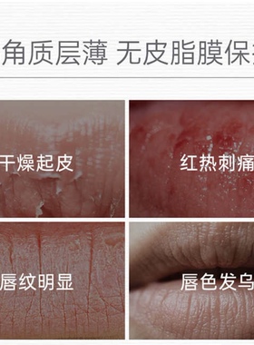 玉泽屏障修护专研保湿唇部精华唇膏按摩干敏温和保湿水滴按摩头