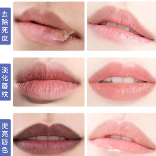 美国碧唇小蓝罐修复润唇膏保湿防干裂滋润Blistex Lip Medex正品 - 图0