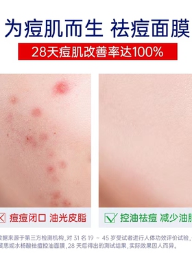 斐思妮水杨酸祛痘控油面膜