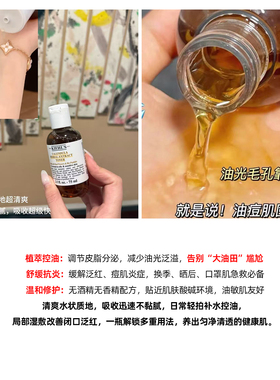 科颜氏金盏花控油祛痘爽肤水
