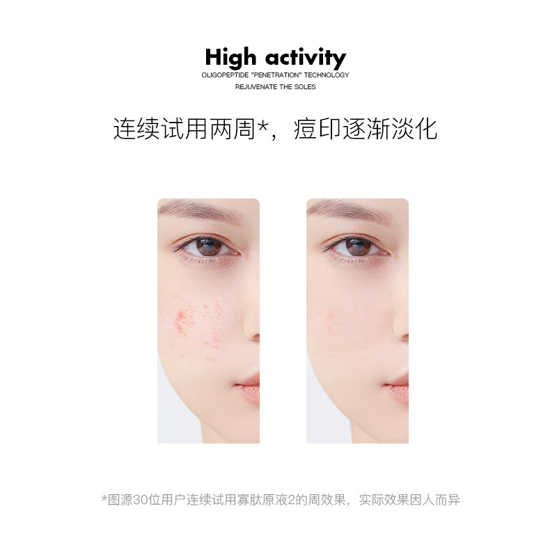 nyas妮雅丝祛痘寡肽淡化冻干粉 NYAS妮雅丝液态精华