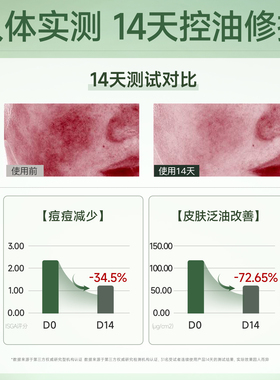 妮雅丝益生菌水乳！14天控油祛痘