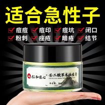Rind and artisan permalink herbal acne cream to pimple varicella pimple pimples acne pimple acne acne men and women