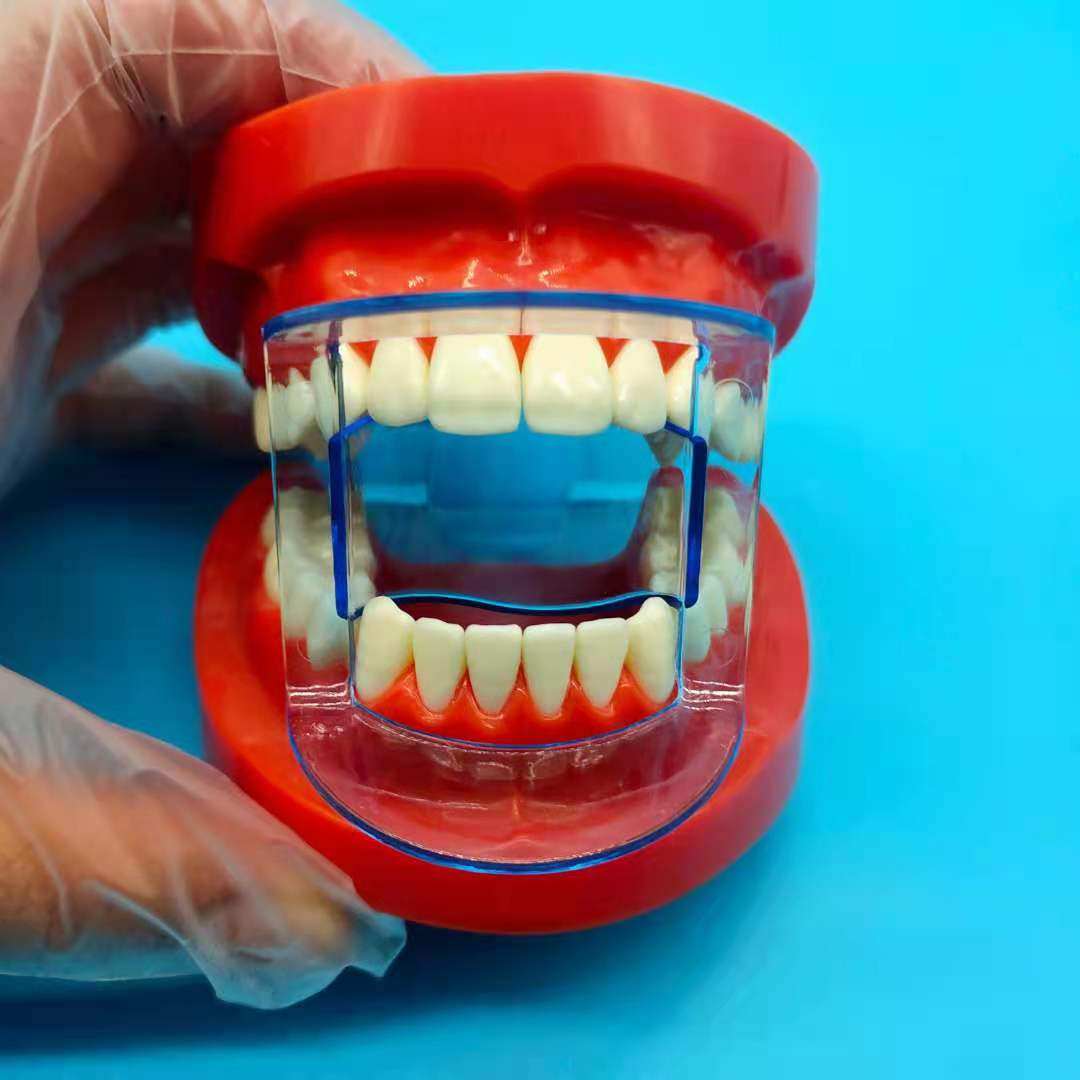 牙科开口器扩口张口咬合垫新款前牙后牙镂空透明设计齿科口腔材料