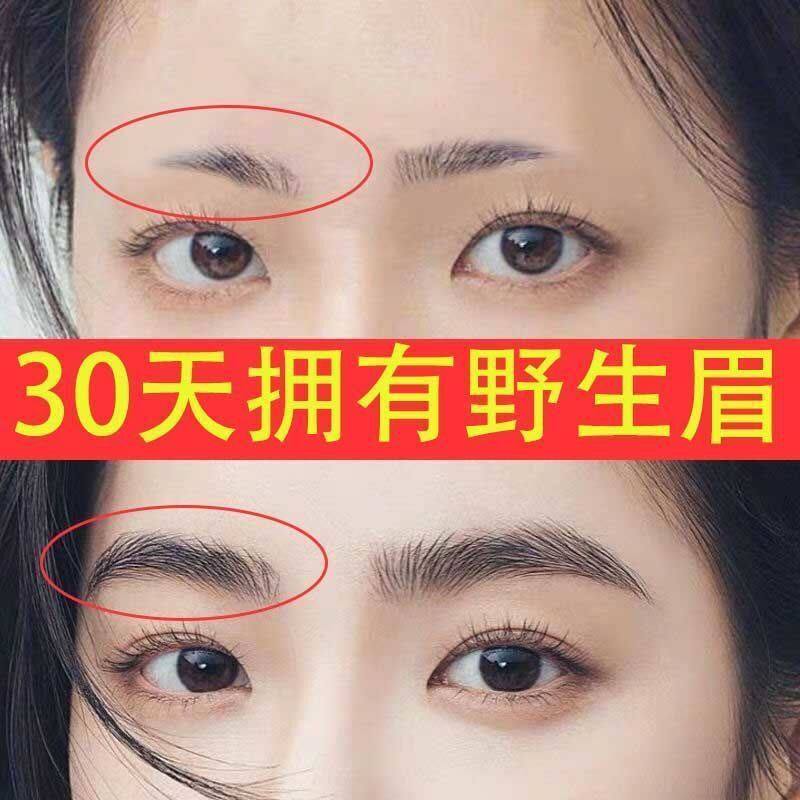 眉毛营养液快速长眉毛增长液女男生眉毛增多生眉液眉毛自然生长液