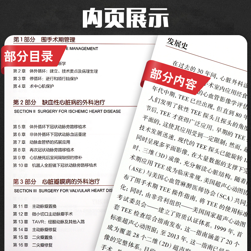 罗伯史密斯心脏外科手术学原著第6版围术期管理缺血性心脏瓣膜心力衰竭胸主动脉心律失常心脏肿瘤外科治疗原则术前评估操作术后-图2