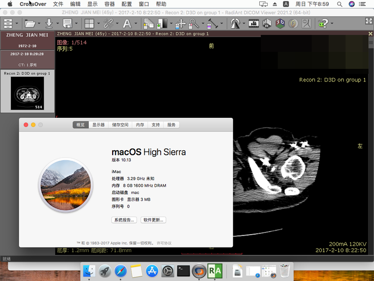 RadiAnt DICOM Viewer医学影像浏览查看三维重建MRP软件苹果macOS-图1