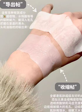 RNW鼻贴去黑头贴粉刺收缩毛孔导出液温和修护净化闭口深层清洁紧