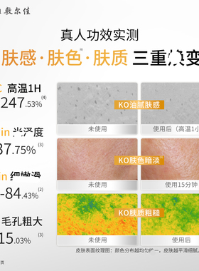 敷尔佳乳糖酸控油敛肤次抛精华
