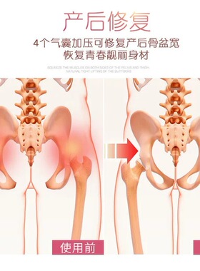 骨盆修复前倾矫正器产后
