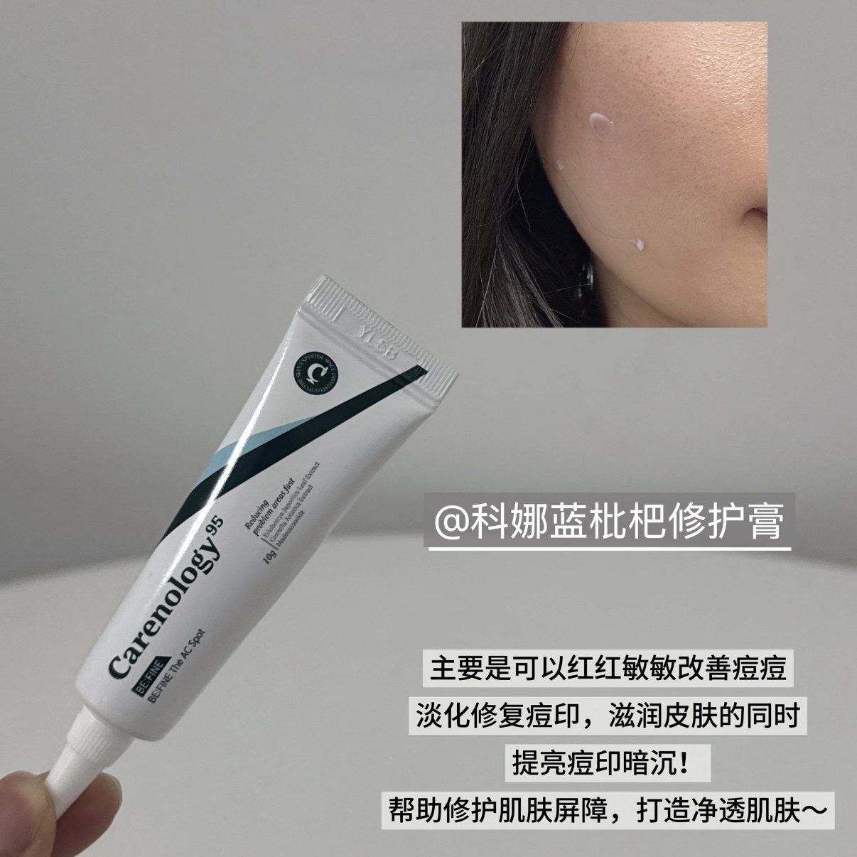 小韩院线级修护！科娜蓝祛痘膏枇杷修护霜温和舒缓去痘改善油痘皮,淘宝优惠券,粉丝福利购,淘宝优惠卷