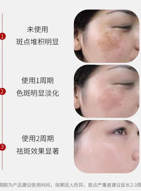 老年人专用强效去除专用药膏