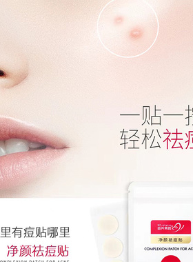 苗方清颜净颜祛痘贴秘方贴痘痘贴痘粉刺闭口淡化痘印不闷痘120贴