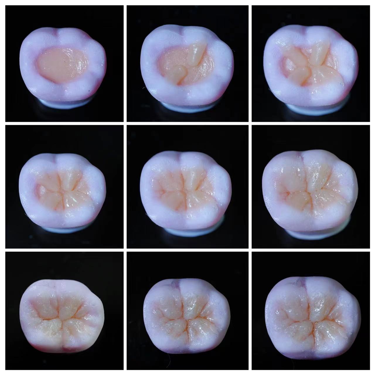 牙医 树脂堆塑练习I类洞模型 上下6号牙 颜色随机 - 图2