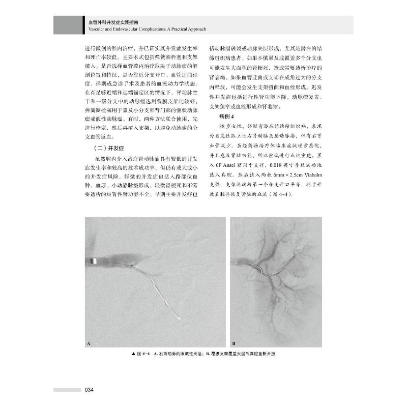 血管外科并发症实践指南 (美)萨卡·辛格·汉斯,(美)马克·F.康拉德 著 崔明哲,张克伟,李晓健 译 外科学生活 新华书店正版图书籍 - 图3