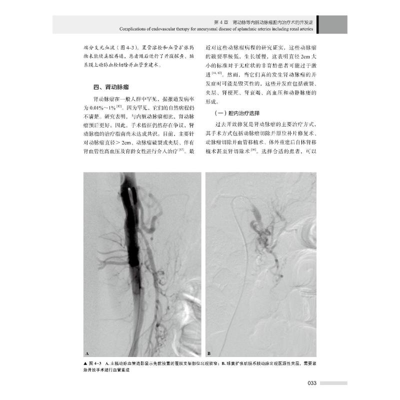 血管外科并发症实践指南 (美)萨卡·辛格·汉斯,(美)马克·F.康拉德 著 崔明哲,张克伟,李晓健 译 外科学生活 新华书店正版图书籍 - 图2