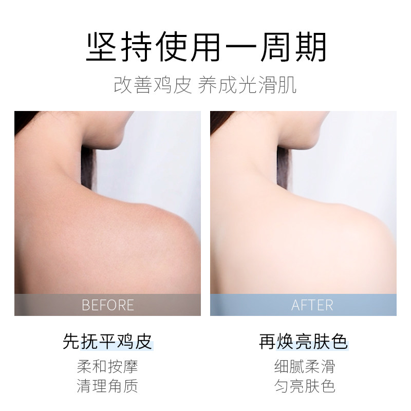 芬逸磨砂膏去改善鸡皮肤全身烟酰胺 芬逸化妆品身体磨砂