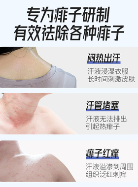 成人祛痱止痒喷雾|消热痱解急痒