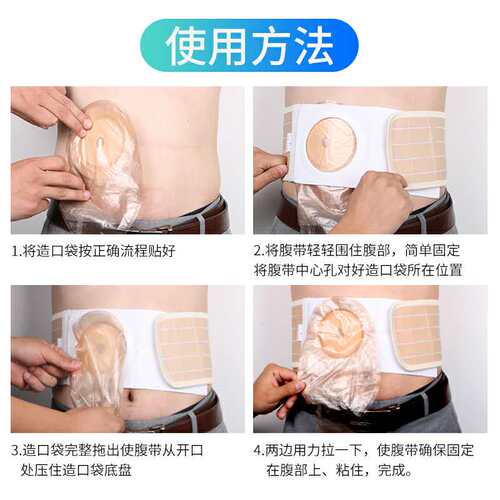 航晟造口腹带舒适透气结肠造瘘用腰带防控疝固定底盘袋子专用护理 - 图2