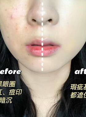 遮瑕膏遮盖斑点痘印黑眼圈
