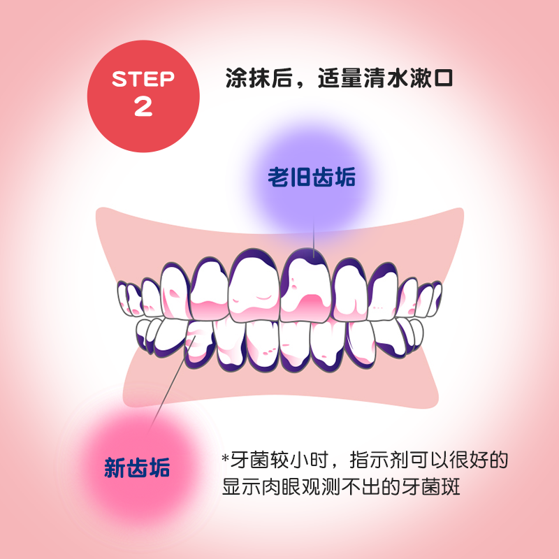 牙菌斑显示剂 日本CI儿童成人口腔齿垢菌斑染色剂刷牙指示剂正畸