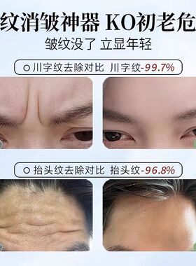 专利配方!抬头纹救星抗皱神器