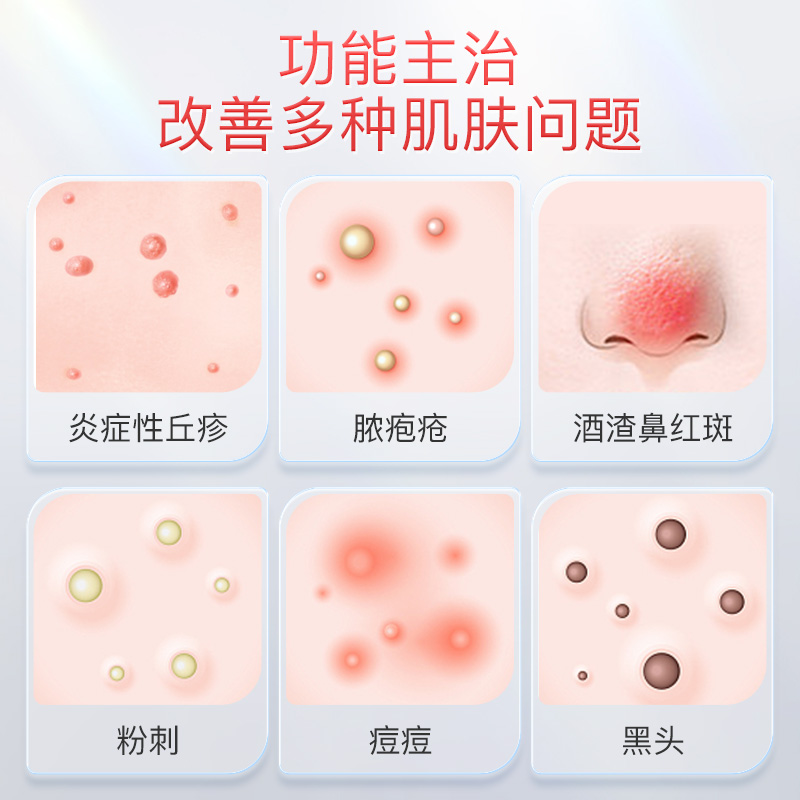 喜辽妥甲硝唑凝胶20g 祛痘脓胞疮酒渣鼻红斑炎症丘疹非痘印非淡化