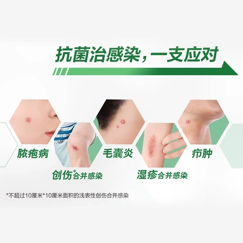 百多邦 Мупироцин мази подлинная 5 г/15 г фолликулита инфекция кожи экзема моксироцин мупицин