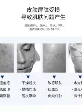点痣后修复膏专用修护液激光点斑术后去红黑印防疤痕凹坑修复因子
