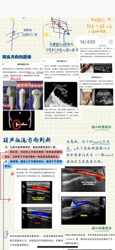 超声笔记医学超声诊断规培结业考手写超声笔记A4铜版纸复印纸打印 - 图0