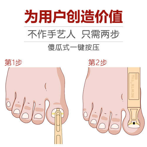 牛贴PRO2足博仕磁力套装嵌甲正甲贴甲沟修脚刀指甲刀剪钳长肉里炎 - 图0