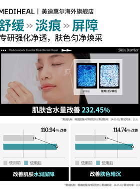 热销款积雪草净透面膜