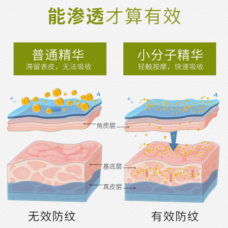日本madonna孕妇专用修复精华素 Akasugu海外妊娠纹护理
