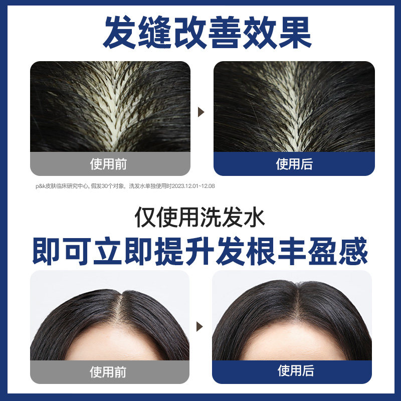 韩国LG Dr.Groot /克洛特缓解掉发洗发水无硅油滋养洗头膏 男女士,淘宝优惠券,粉丝福利购,淘宝优惠卷