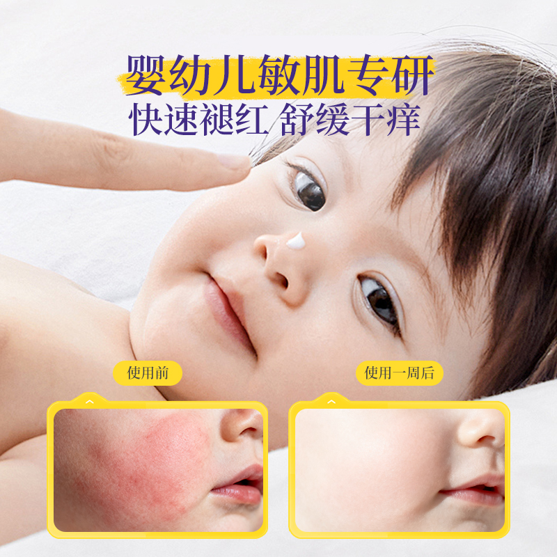 【自营】加州宝宝金盏花面霜秋冬儿童新生婴儿滋润保湿宝宝霜57g