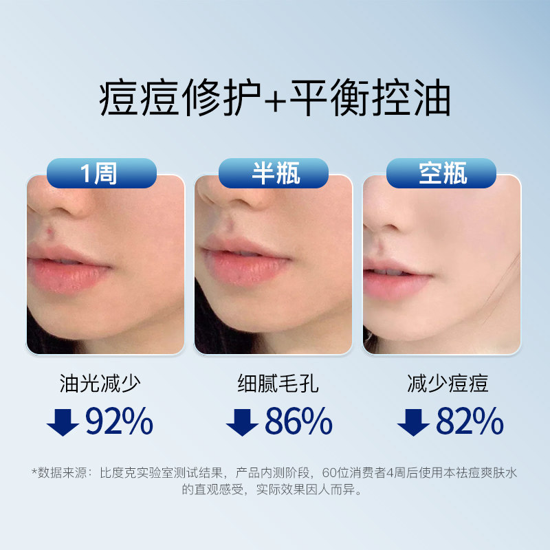 比度克祛痘男女抗痘补水控油爽肤水 bedook化妆品化妆水/爽肤水