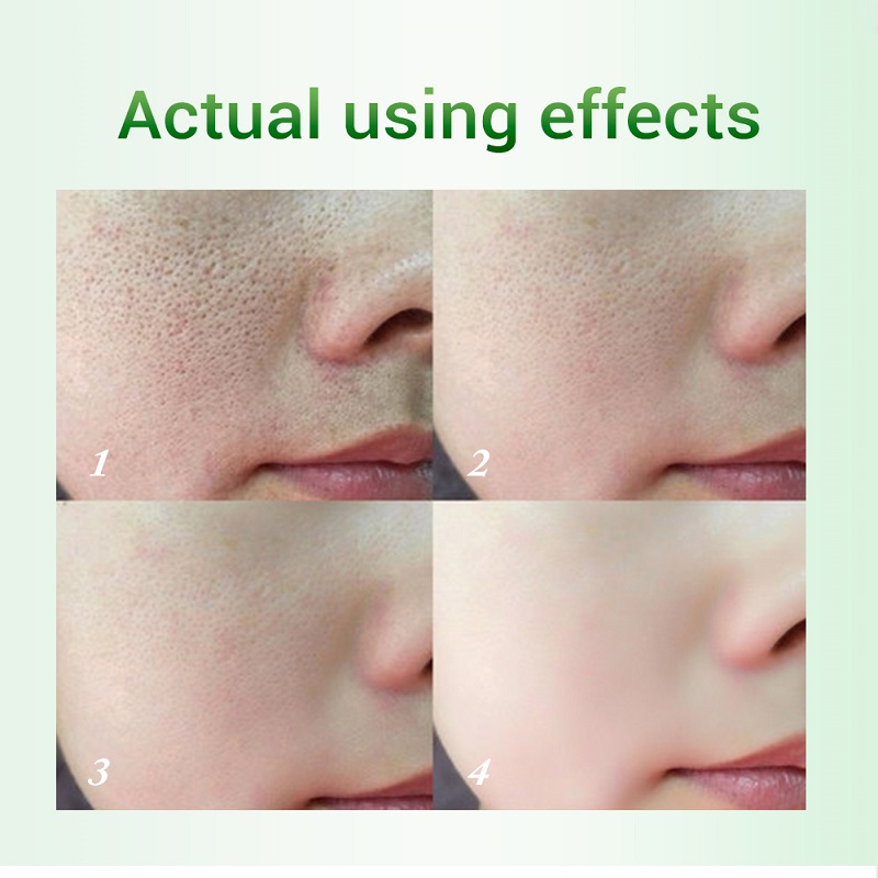 20ml Salicylic Acid Pores Refining Cream Shrink Pore Improve - 图3