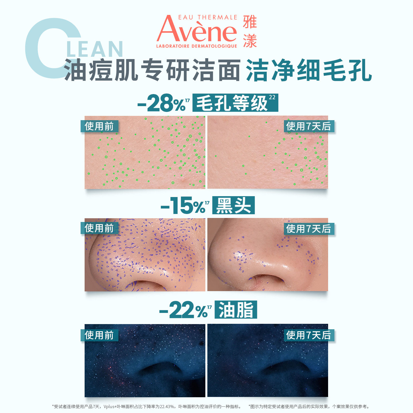 【会员日预售】雅漾控油净肤洁面凝胶敏感肌深层清洁洗面奶avene