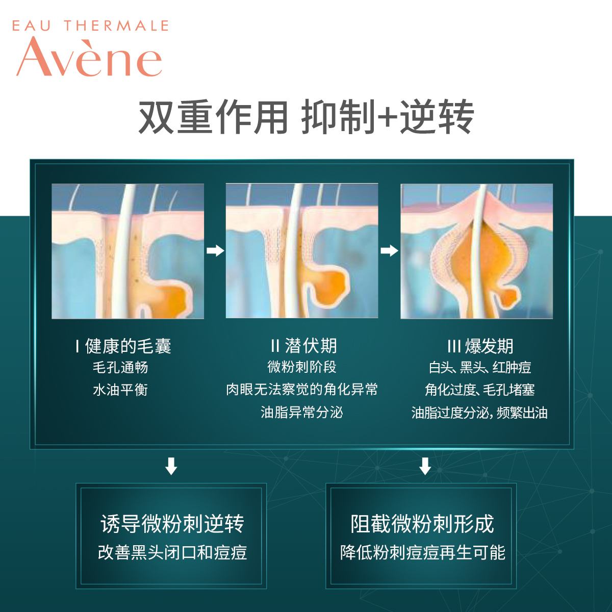 节预售 敏肌温和祛痘印痘坑修护女 30ml 38 控油抗痘修护精华露 节预售 敏肌温和祛痘印痘坑修护女 30ml 38 控油抗痘修护精华露