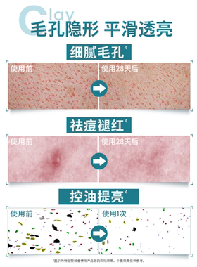 【双11现货速达】雅漾反孔小绿泥膜祛痘红深层清洁毛孔涂抹面膜