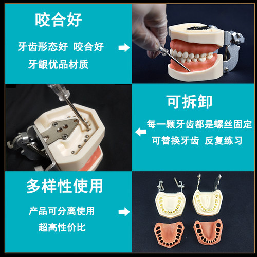 理月口腔牙科牙齿模型备牙练习软牙龈牙模可拆缷仿真树脂离体 - 图0
