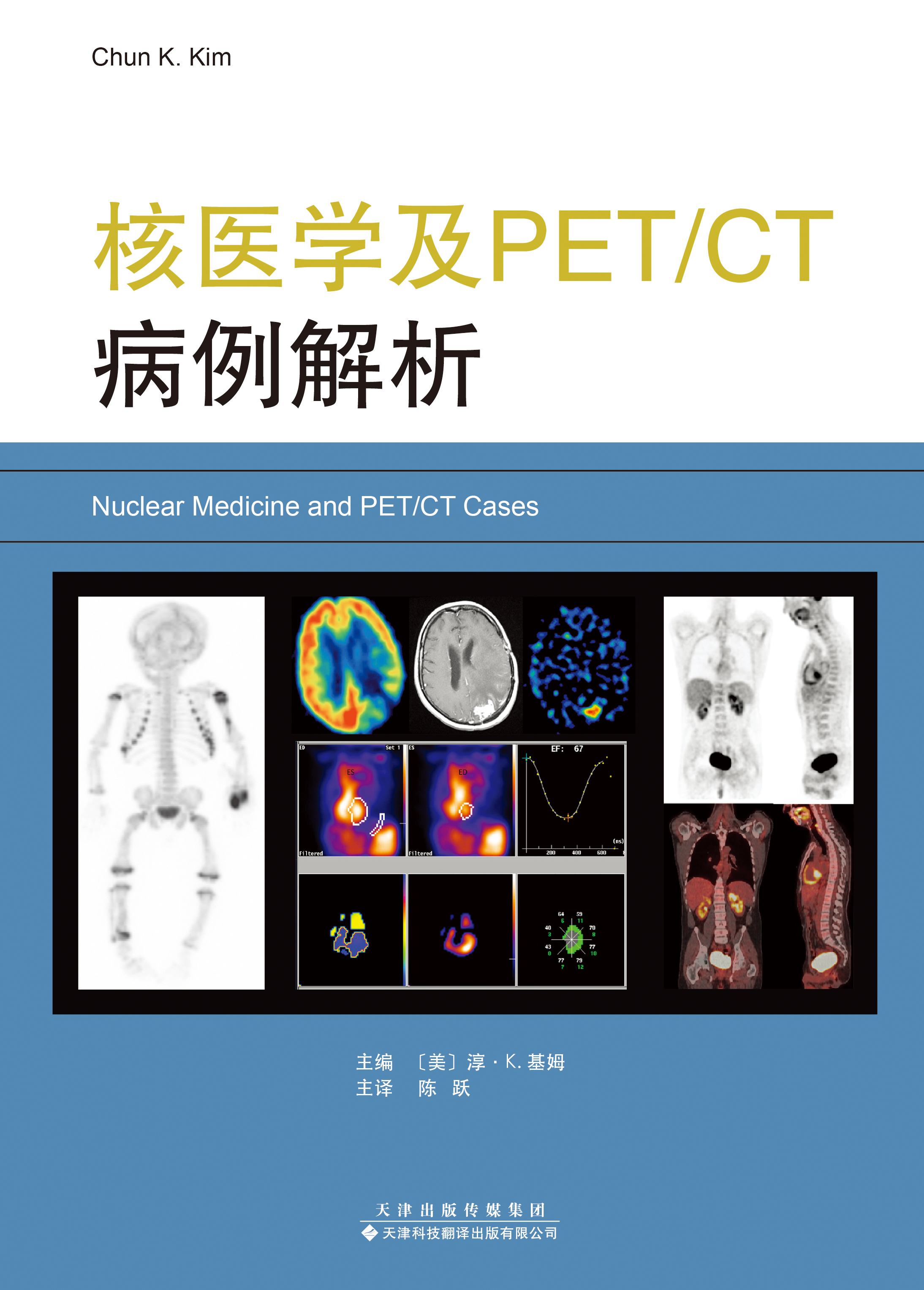 【官方直营】核医学及PET/CT病例解析【美】淳•K.基姆 陈跃 核医学书籍 临床医学 影像医学书籍 儿科核医学 肿瘤肝脏 脾脏肾 胆管 - 图1