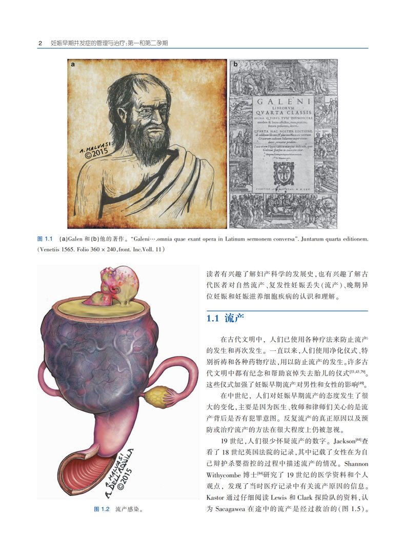 【出版社直发】妊娠早期并发症的管理与治疗:第一和第二孕期 排除和处理妊娠早期疾病 妇产科专家 流产异位妊娠子宫肌瘤滋养细胞